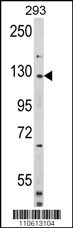 DAAM2 Antibody