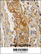 ACPP Antibody
