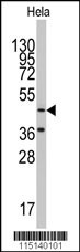 NARS2 Antibody