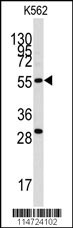 CLIC5 Antibody
