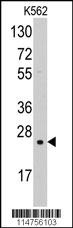 SOD2 Antibody