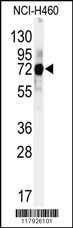 CUL5 Antibody