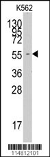 FARSA Antibody