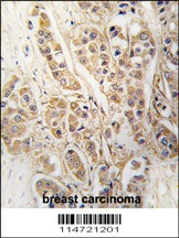 CLIC4 Antibody