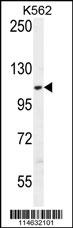 AARS2 Antibody