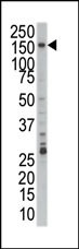 PRPF4B Antibody