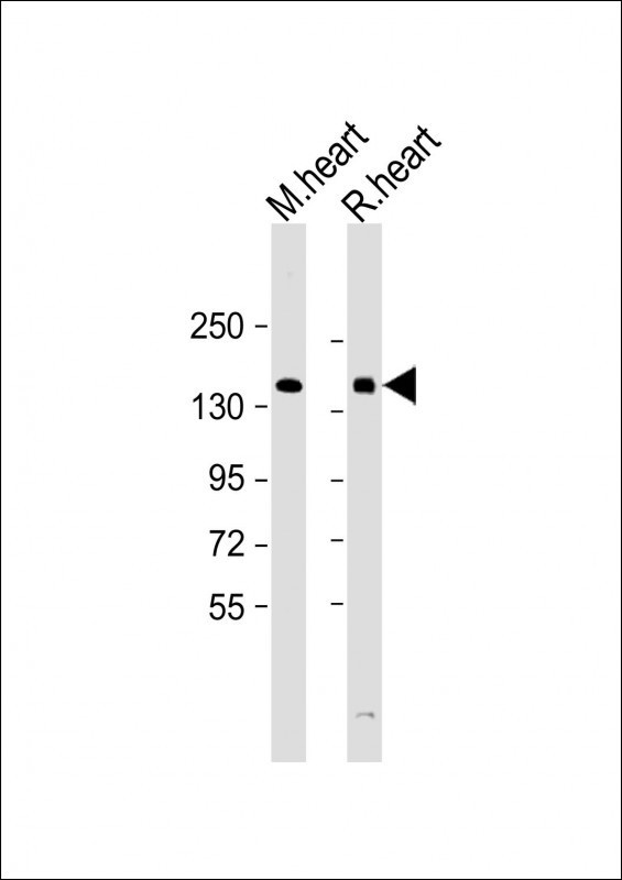 HIPK3 Antibody