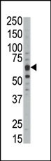 DYRK1B Antibody