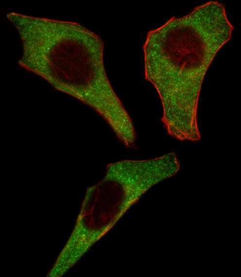 CDK4 Antibody