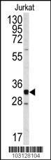 CDK2 Antibody