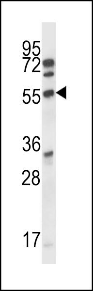 CDK15 Antibody