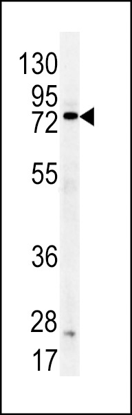DDX53 Antibody