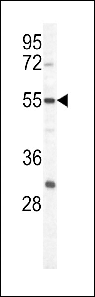 PKM Antibody
