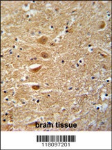 KIF3C Antibody