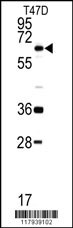 DDX5 Antibody