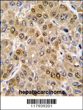 DDX5 Antibody