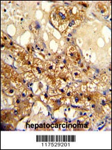 CYP20A1 Antibody