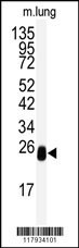 DCXR Antibody