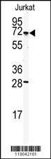 CETP Antibody