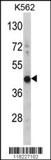 HIBCH Antibody