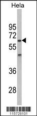 PRKAA2 Antibody