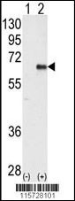PRKAA2 Antibody