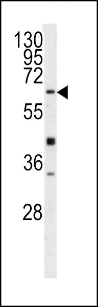 GGT5 Antibody