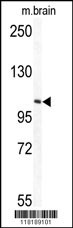 TECPR1 Antibody