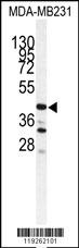 CTSS Antibody