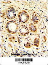 CTSK Antibody