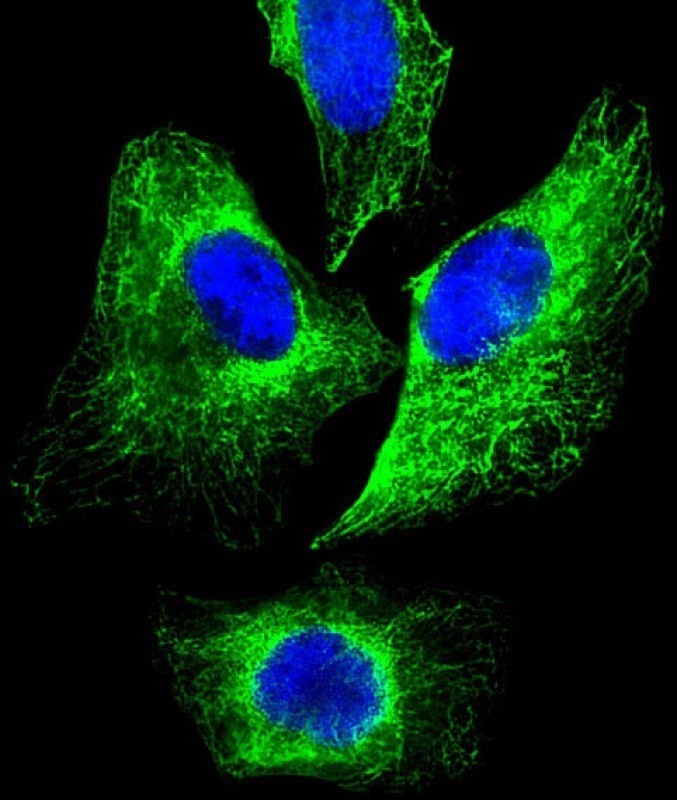 KRT18 Antibody