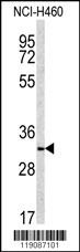 NQO1 Antibody