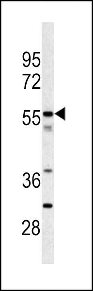 CPN2 Antibody