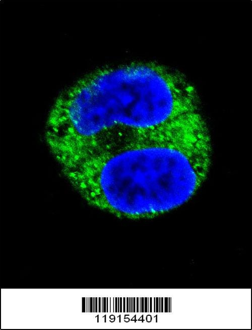 TYR Antibody