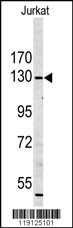 MYO1A Antibody