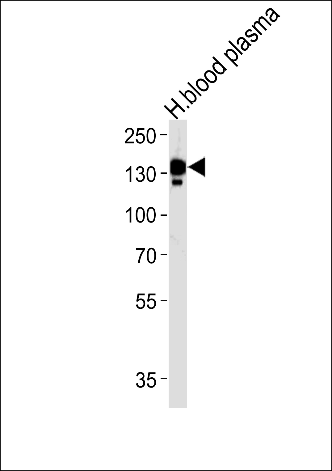 CP Antibody