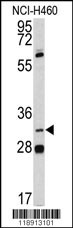 PITX1 Antibody