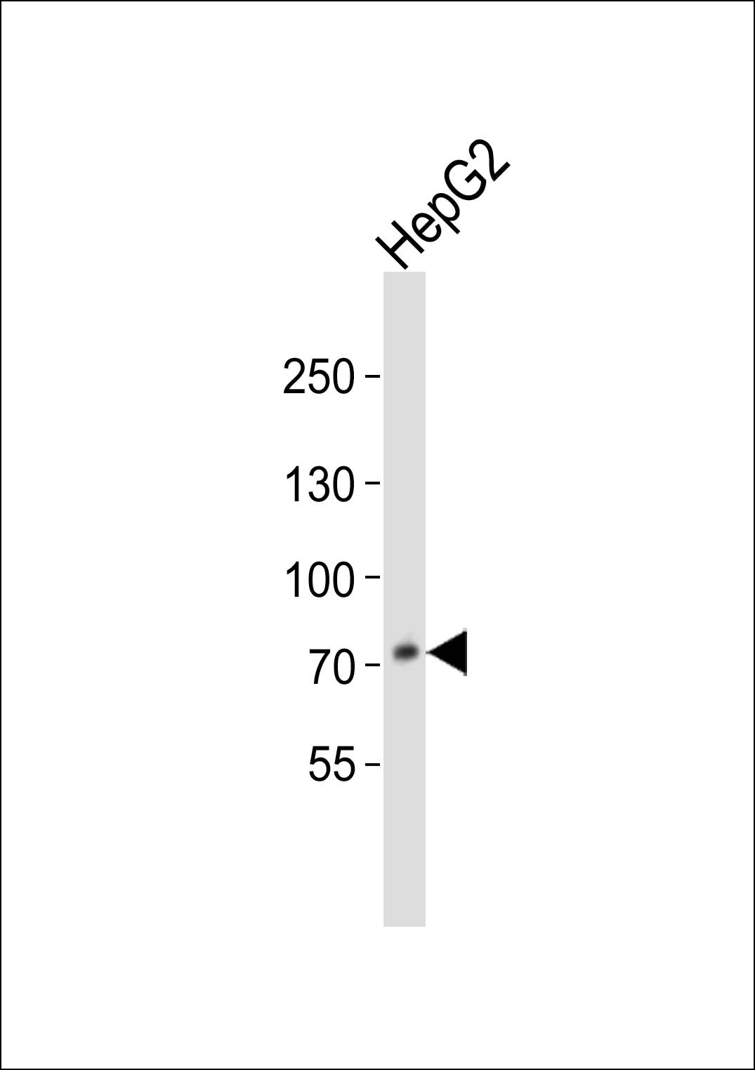 PCSK9 Antibody