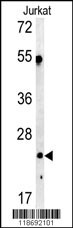 C1QA Antibody