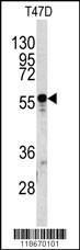 A1BG Antibody