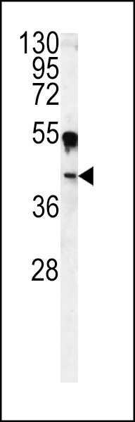 CA14 Antibody