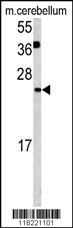 GLRX2 Antibody