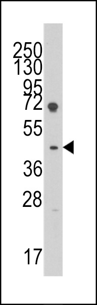 LEFTY1 Antibody