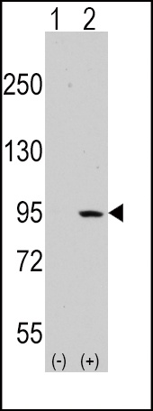 DDR1 Antibody