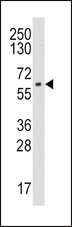 Aromatase Antibody