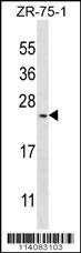 BARX1 Antibody