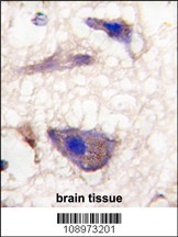 Nptx1 Antibody