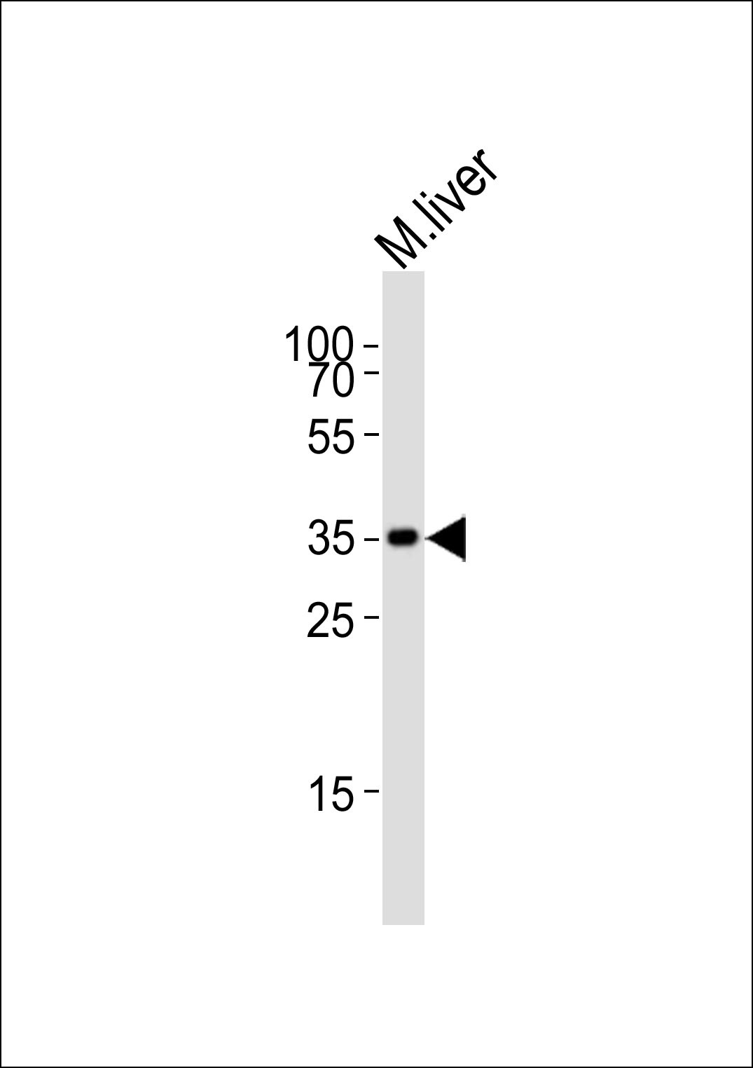HMX2 Antibody