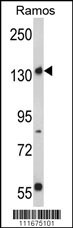 RICTOR Antibody