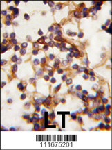 RICTOR Antibody